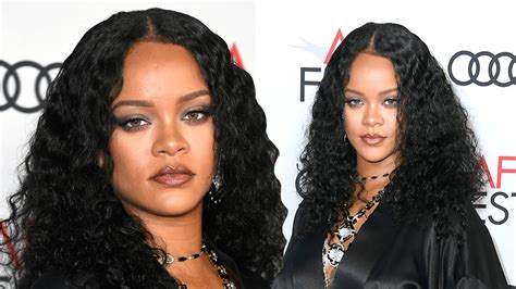 Rihanna suffers bruised face and black eye after electric scooter crash ...