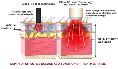 Laser Therapy