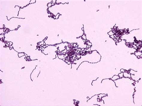 Streptococcus Gram Stain Morphology