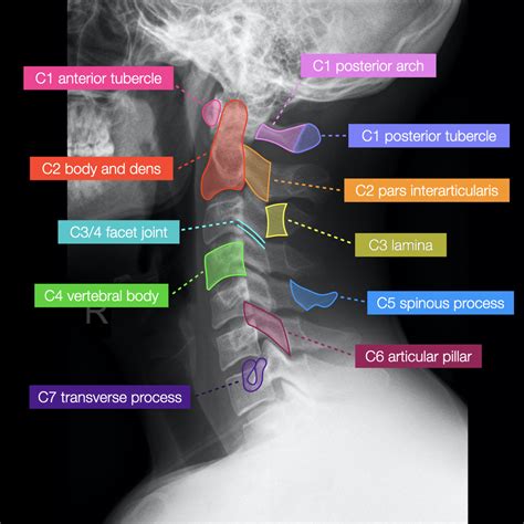 Healthy cervical spine x ray - assesec