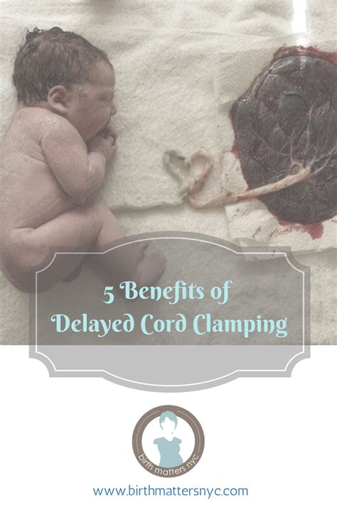 5 Benefits to Baby of Delayed Cord Clamping — Birth Matters