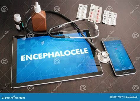 Encephalocele (cutaneous Disease) Diagnosis Medical Concept on T Stock ...