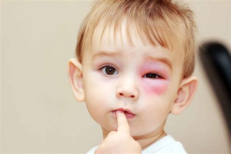 Tips on How to Prevent Eye Injuries in Children - Laurier Optical | Innes Eye Clinic