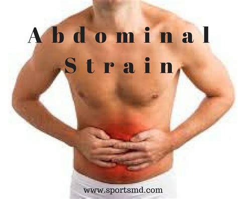 Abdominal Muscle Strain - How to Treat and Recover | Muscle strain, Abdominal muscles, Abdominal