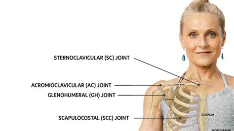 Dislocation of Sternoclavicular Joint and Acromioclavicular Joint ...