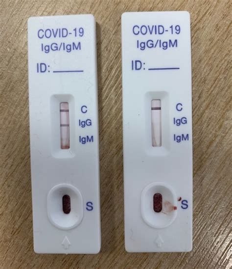 Influenza Test Kit Results at Valerie Hogan blog