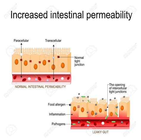 Glycemic response & Chronic Inflammation - Genefitletics