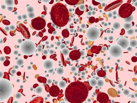 Thrombocytopenia: Symptoms, Causes, and Treatment - Daily Info on Health