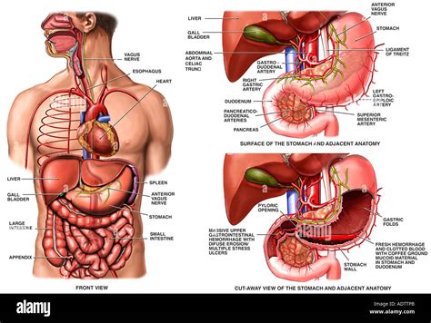 Upper gastrointestinal bleeding hi-res stock photography and images - Alamy