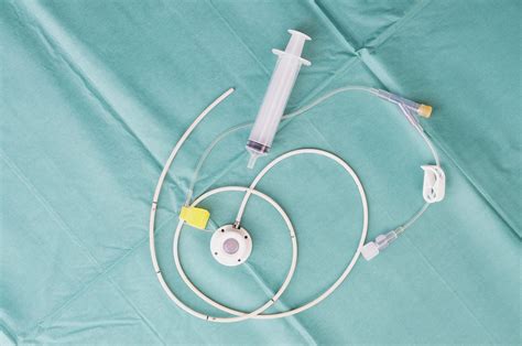 Understanding Vascular Access Devices | USA Oncology Centers