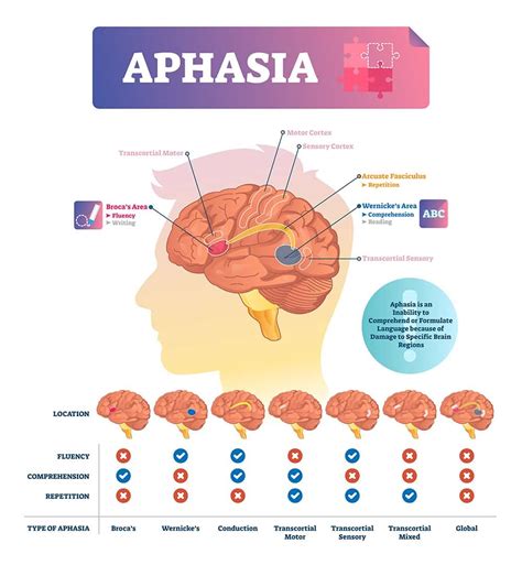 14 Warning Signs and Symptoms of Brain Tumor