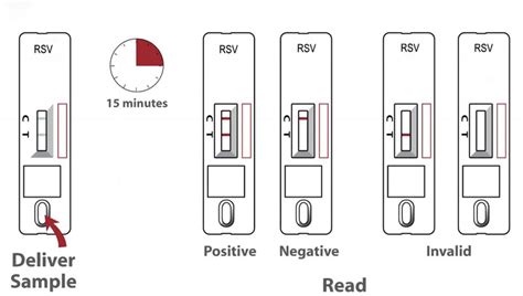 China Cheap RSV Antigen Rapid Test Device Manufacturers Suppliers ...