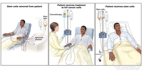 Definition of autologous stem cell transplant - NCI Dictionary of ...