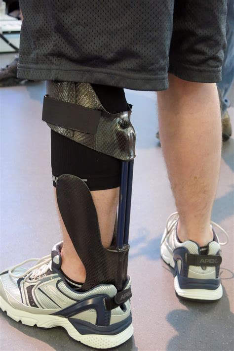 Orthotic Brace Takes Soldiers From Limping To Leaping | Health News Florida