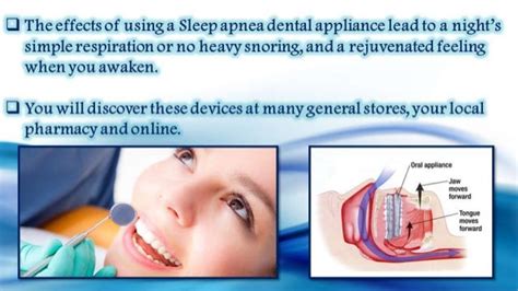 Sleep Apnea Dental Appliance