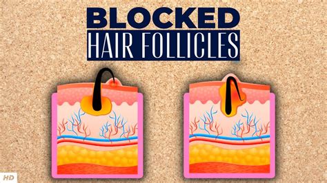 Hair Follicles Bumps