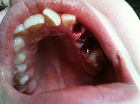 Lori Green: The Twisted Tooth (don't look if you're squeamish)