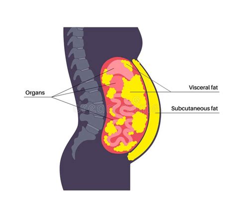 Visceral fat diagram stock vector. Illustration of abdominal - 281039679