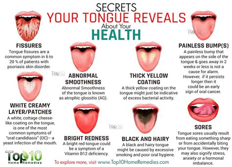 10 Secrets Your Tongue Reveals about Your Health | Top 10 Home Remedies