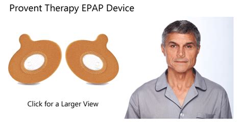 The Provent EPAP device for treating Obstructive Sleep Apnea