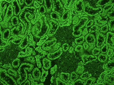 Anti-mitochondrial antibodies (AMA) positive control - Launch Diagnostics