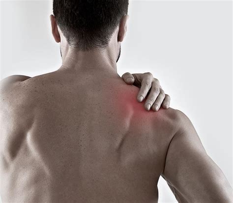 Pictures of a separated shoulder. Shoulder Separation: Causes, Symptoms ...