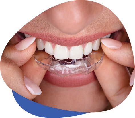 We Offer Treatments for Bruxism & TMJ in Westerville