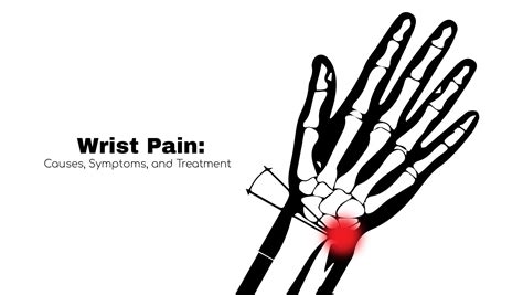 Wrist Pain: Causes, Symptoms, and Treatment ~ Stat! Cardiologist