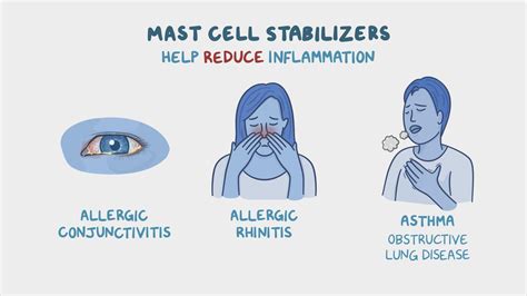 Mast cell stabilizers - Inhaled: Nursing pharmacology - Osmosis Video Library