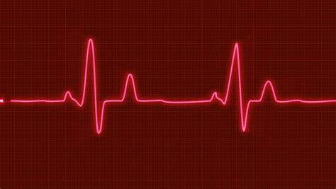 Looped Animated Ecg Electrocardiogram Display. Stock Footage Video (100% Royalty-free) 14718199 ...