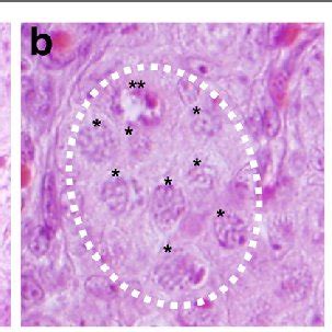 (PDF) Arrest at the diplotene stage of meiotic prophase I is delayed by ...