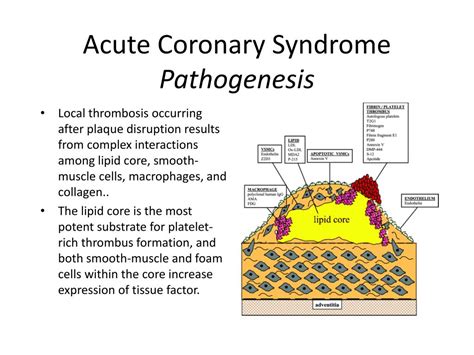 PPT - Acute Coronary Syndrome The Essentials PowerPoint Presentation, free download - ID:2224350