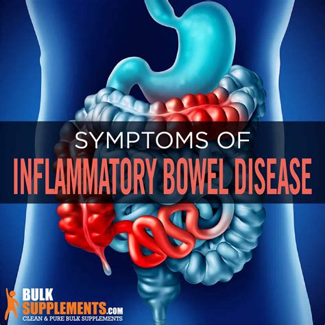 Inflammatory Bowel Disease (IBD): Symptoms, Causes & Treatment