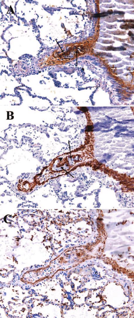 Caveolin 1 expression in alveolar septal cells (arrows), smooth-muscle... | Download Scientific ...