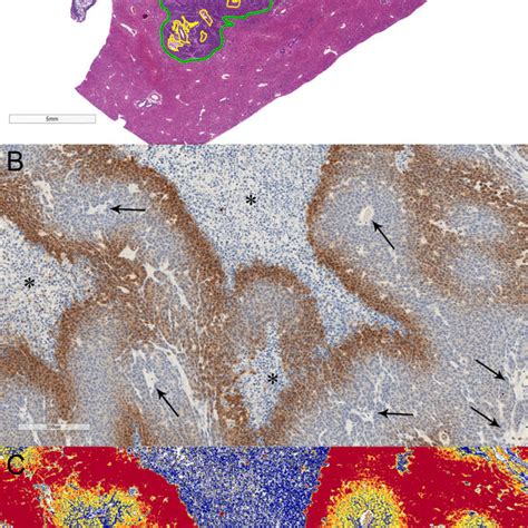 Quantitative analysis of tumor hypoxia microenvironment changes by ...