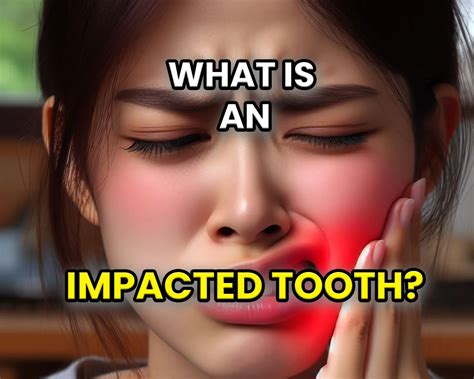 What is an Impacted Tooth? - Symptoms, Diagnosis and Treatment