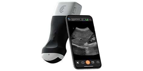 Portable Pocket Handheld Ultrasound Scanners - Clarius