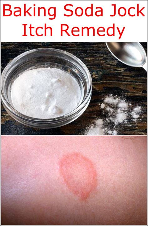 Baking Soda Jock Itch Remedy | Baking Soda Uses and DIY Home Remedies.