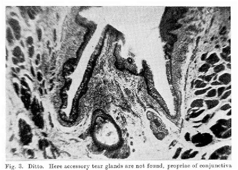 Figure 3 from On the Histology and Innervation of Caruncula Lacrimalis ...