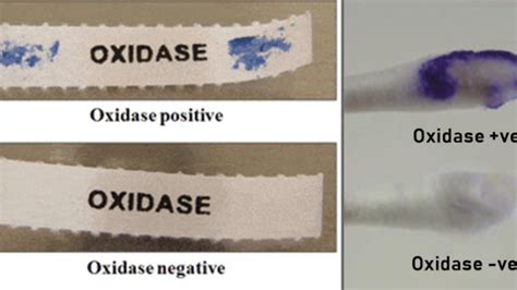 Oxidase test: Principle, Procedure, Result interpretation and Precautions - Online Biology Notes