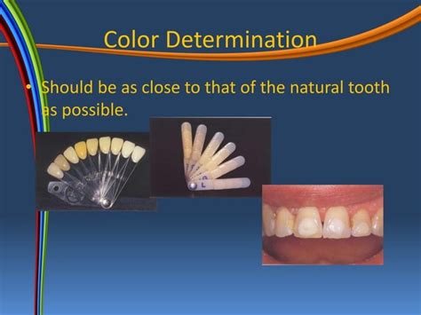 Composite resin | PPT