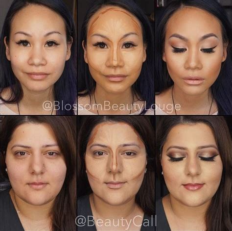 Before and after photos of Face Contouring :: Rinnoo.net Website