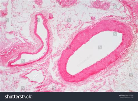 Vein Histology: Over 692 Royalty-Free Licensable Stock Photos | Shutterstock