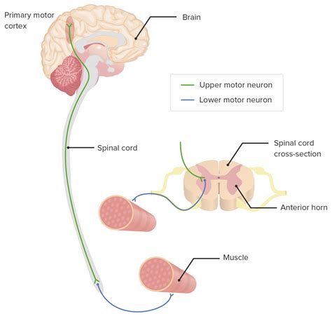 What Is A Lower Motor Neuron Injury | Webmotor.org