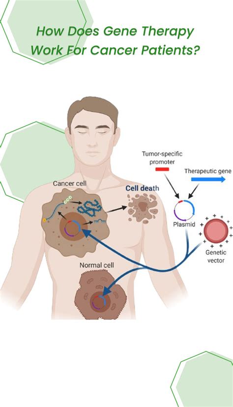 Gene Therapy for Cancer- A New Era in Cancer Treatment | ClinicSpots