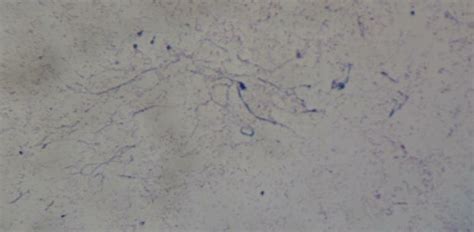 Appearance of Fusobacterium necrophorum in an impression smear under a... | Download Scientific ...