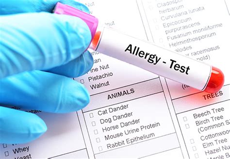 Allergy Testing | Mclean VA & Woodbridge, VA | Skin & Laser Dermatology Center