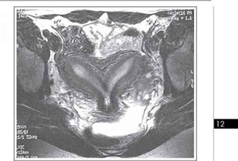 Reproductive Endocrinology Diagnostic Imaging - Infertility