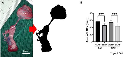 Figure 4 from Anatomy and relationships of forelimb lymph nodes in ...