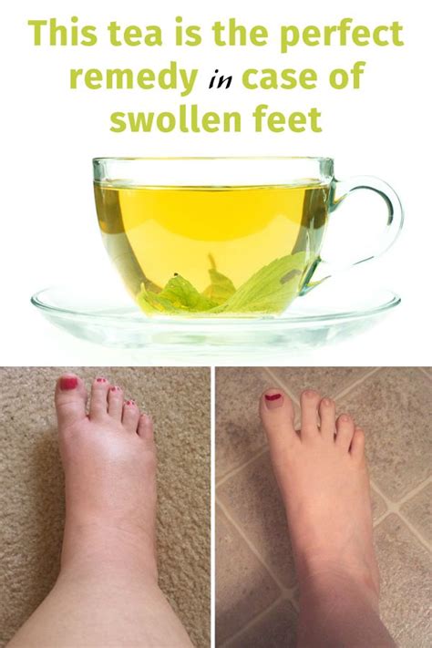 This tea is the perfect remedy in case of swollen feet - Style Idea ...